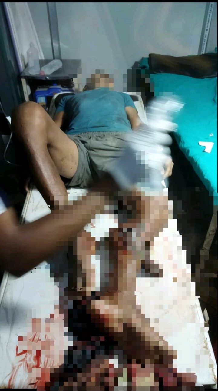 नवलपुरमा गोहीको आक्रमण वाट एक जना गम्भीर घाइते