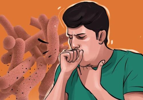 नवलपुरमा आठ महिनामा ४२६ जना क्षयरोगी भेटियो, ११ जनाको मृत्यु